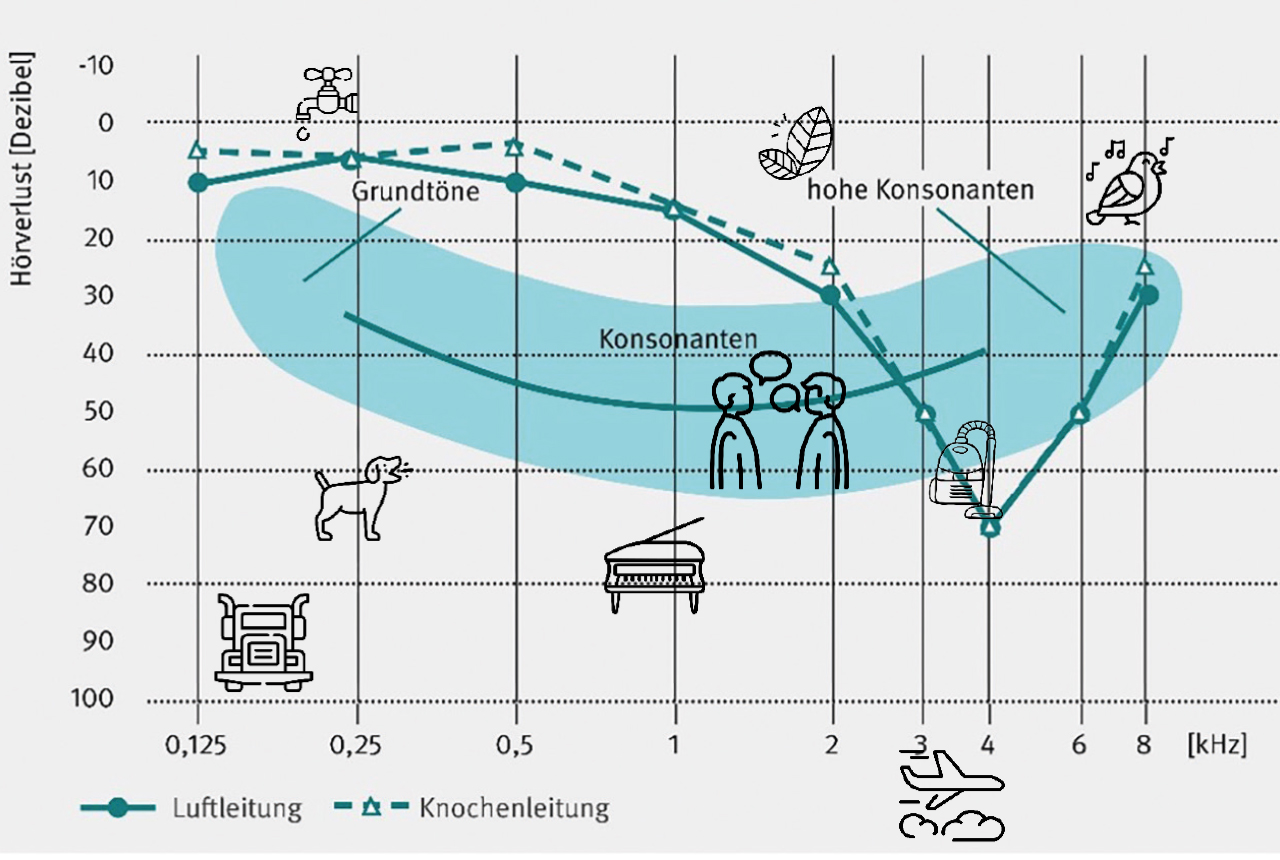 Das Diagramm zeigt die Folgen der Lärmschwerhörigkeit
